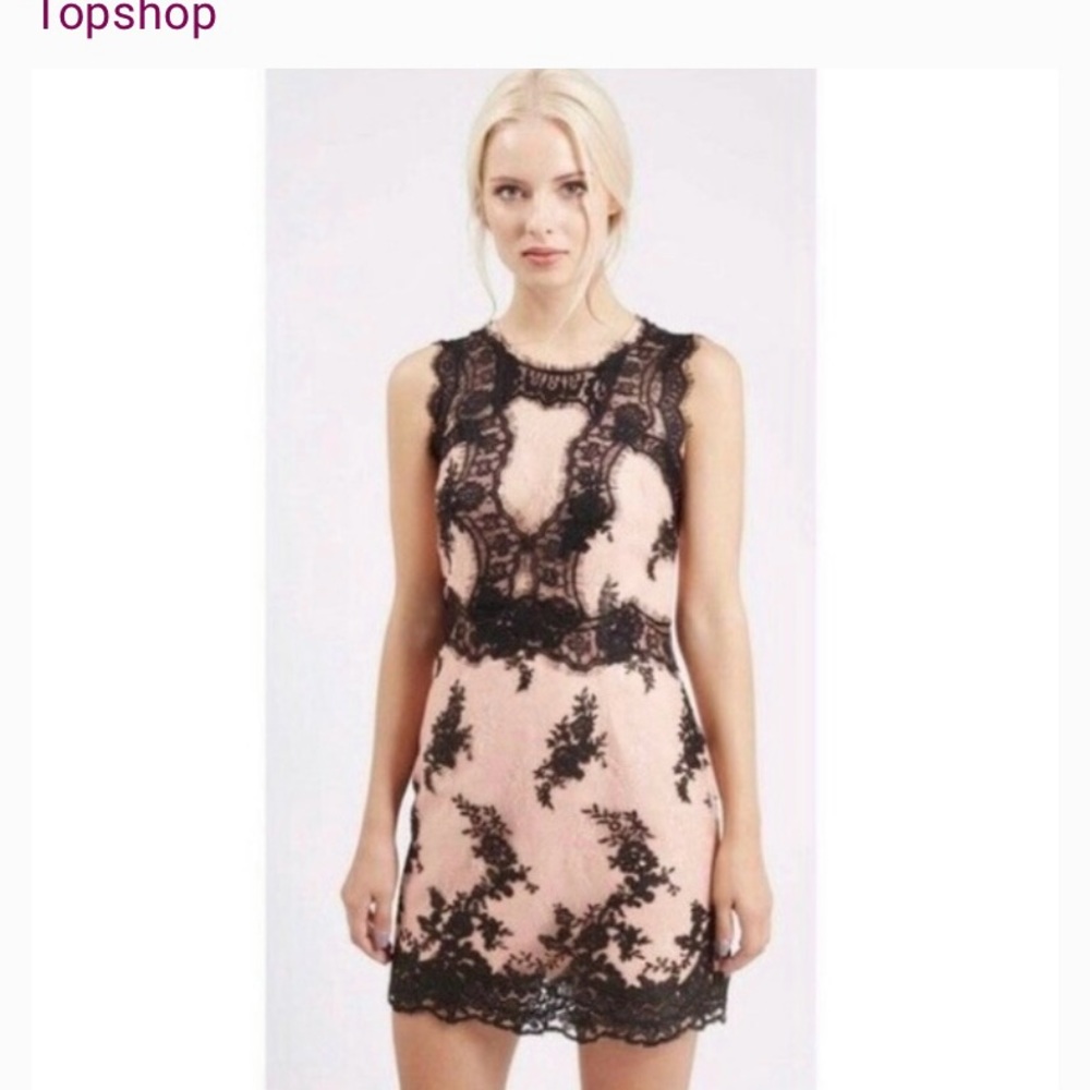 Lace Mini Dress